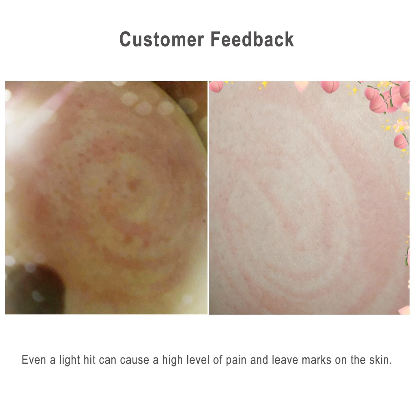 Vibrant Lollipop Silicone BDSM Spanking Paddle – Sweet Yet Stingy! 6 Colors